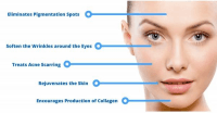 product-sub-image